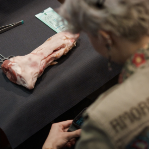 REKORDU POLSKI W SZYCIU CHIRURGICZNYM1