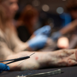 REKORDU POLSKI W SZYCIU CHIRURGICZNYM5